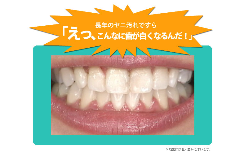 トゥースメディカル ホワイト Iooth Md White